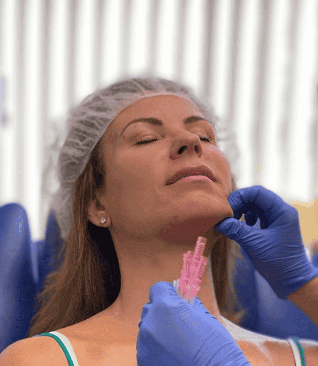 PDO thread treatment at Manushka Aesthetics