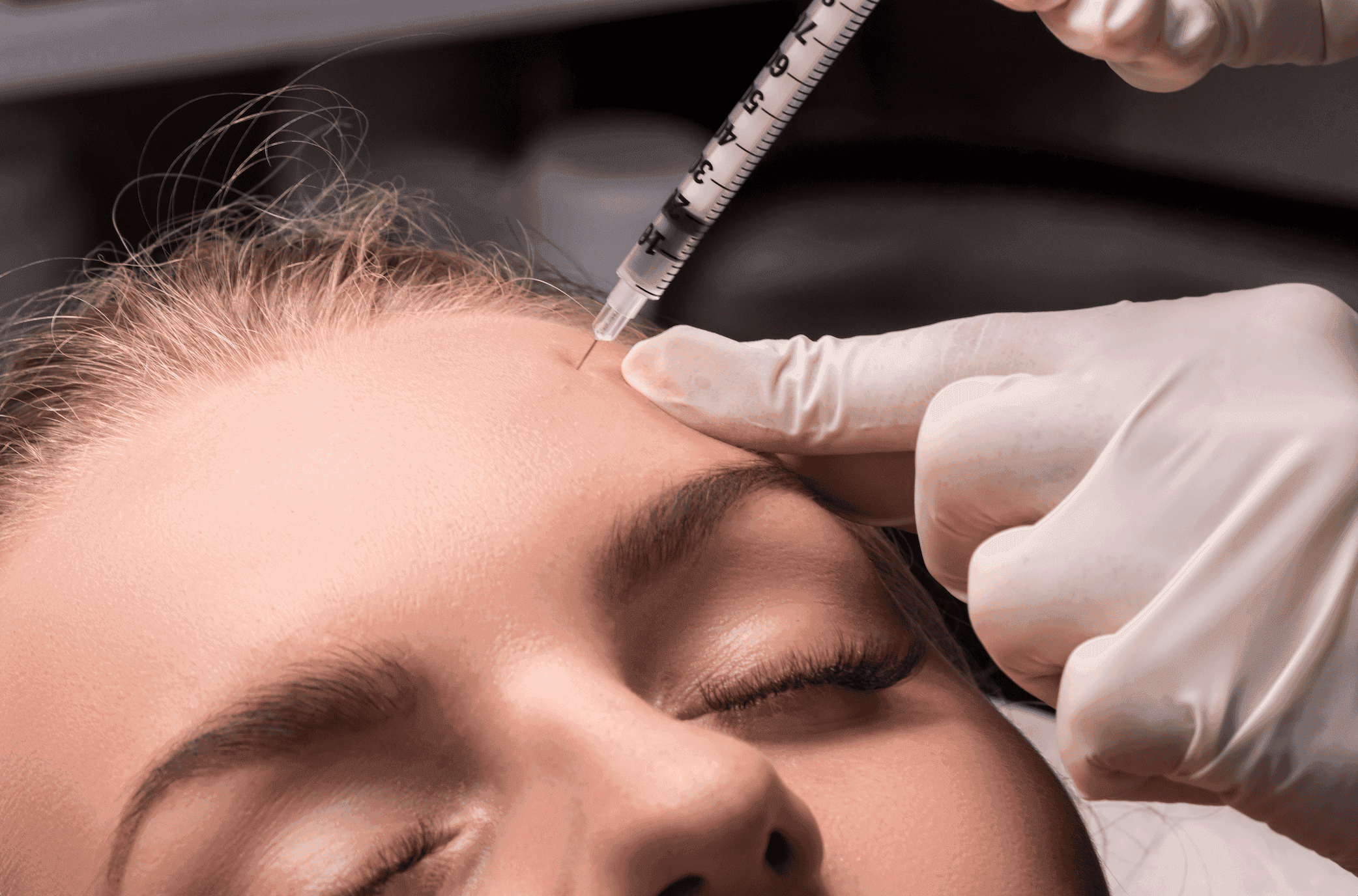 Wrinkle relaxer treatment at Manushka Aesthetics