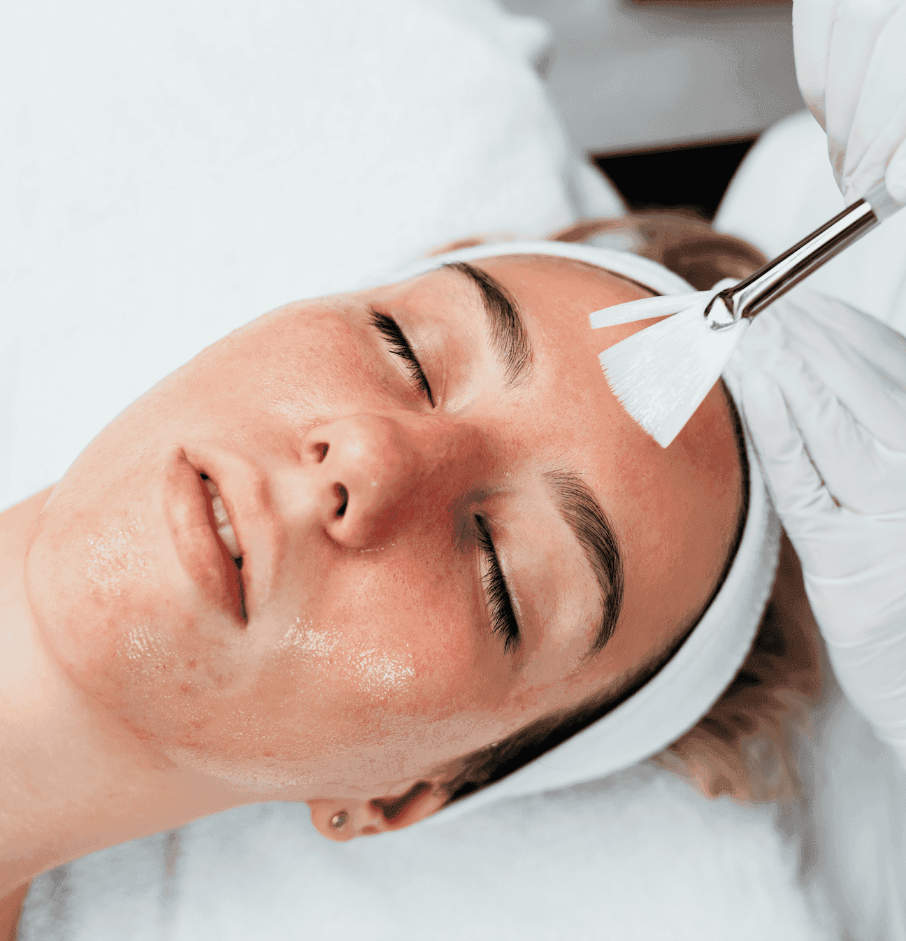Skincare peel treatment at Manushka Aesthetics