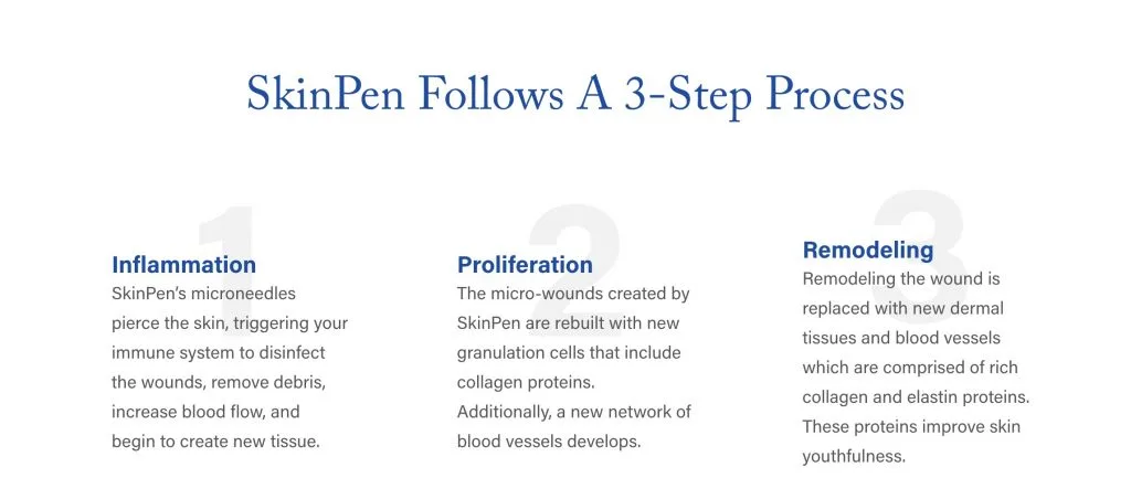 As the very first FDA-cleared microneedling device, SkinPen is trusted by leading dermatologists, aestheticians, and other skincare professionals. Three steps in as little as thirty minutes targets facial acne scars and neck wrinkles, for smoother, more radiant, younger-looking skin.